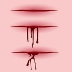 ЧС: Первая помощь при ранах — 3